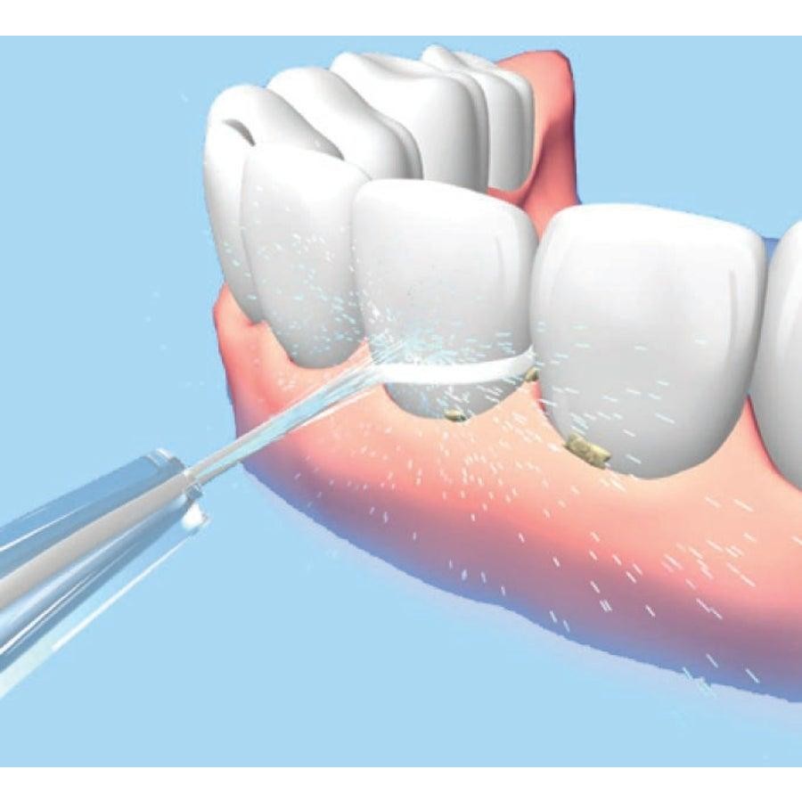 TODO Rechargeable Water Dental Jet Pick Flosser 90 Psi 1500Mah Travel Oral Irrigator