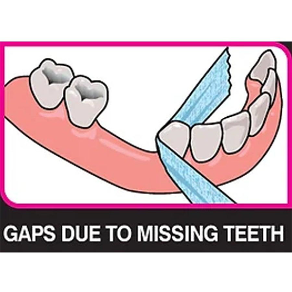 iDontix X-Ribbon Floss Gauze Dispenser- Implant, Braces and Bridge Floss - 12m Dispenser